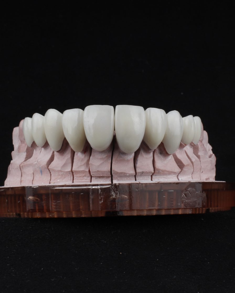 Dentadura fabricada en nuestro laboratorio dental