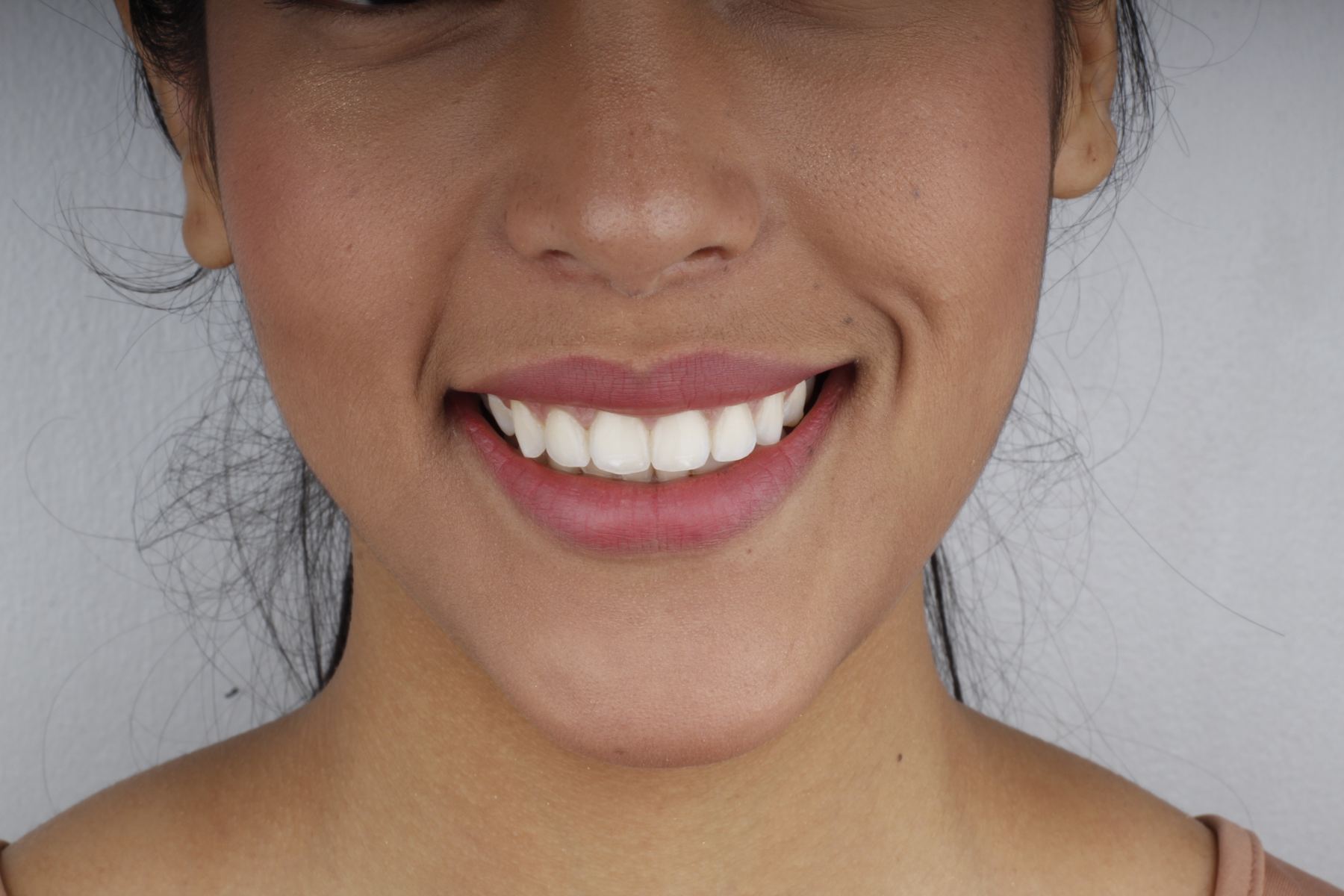 Sonrisa sana y limpia