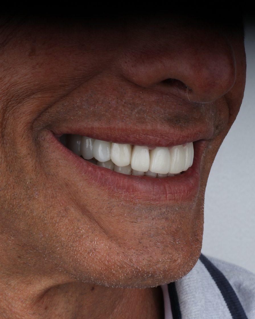 Paciente sonriendo
